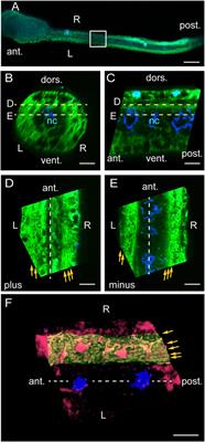 Bilaterally Asymmetric Helical Myofibrils in Ascidian Tadpole Larvae